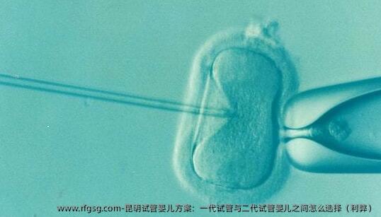 昆明试管婴儿方案：一代试管与二代试管婴儿之间怎么选择（利弊）