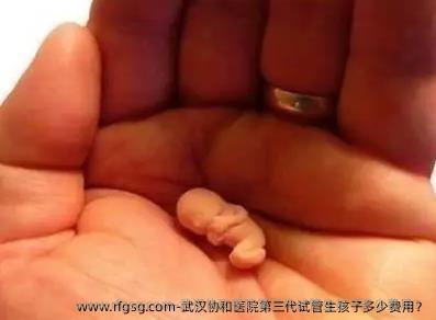 武汉协和医院第三代试管生孩子多少费用？