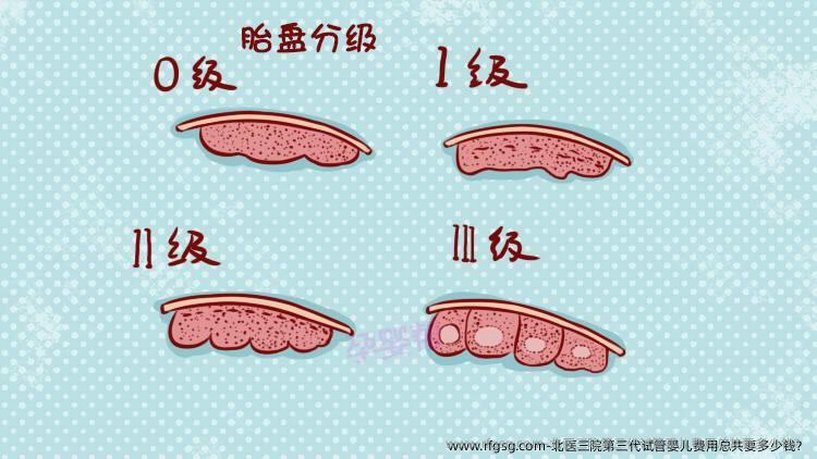 北医三院第三代试管婴儿费用总共要多少钱？