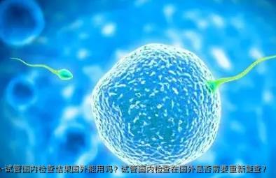 试管国内检查结果国外能用吗？试管国内检查在国外是否需要重新复查？