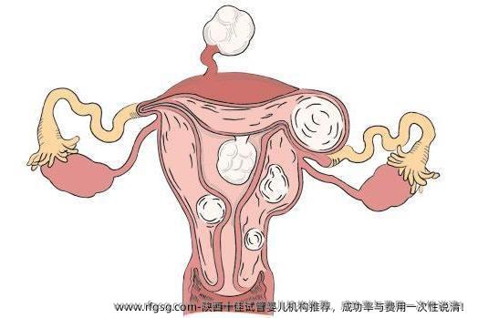 陕西十佳试管婴儿机构推荐，成功率与费用一次性说清！