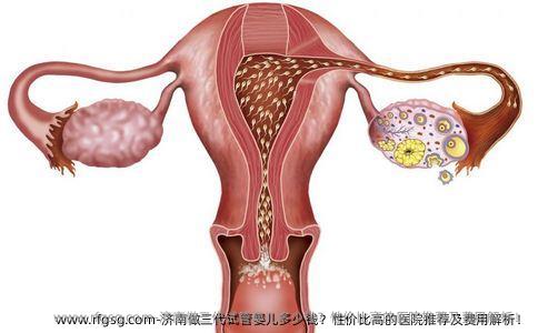济南做三代试管婴儿多少钱？性价比高的医院推荐及费用解析！