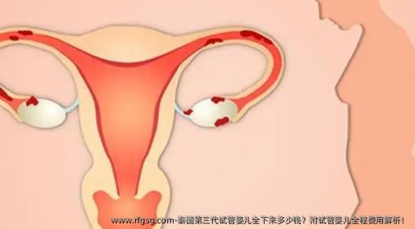 泰国第三代试管婴儿全下来多少钱？附试管婴儿全程费用解析！