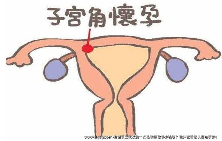 贵州第三代试管一次成功需要多少钱呀？贵州试管婴儿费用详解！