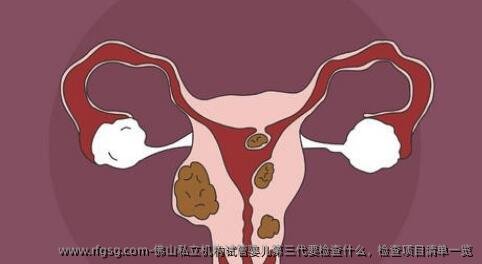 佛山私立机构试管婴儿第三代要检查什么，检查项目清单一览