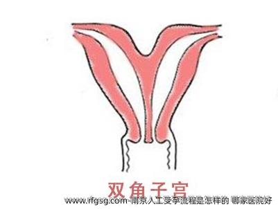 南京人工受孕流程是怎样的 哪家医院好