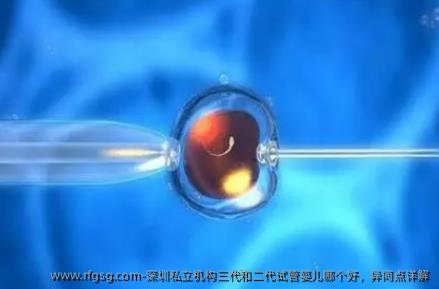 深圳私立机构三代和二代试管婴儿哪个好，异同点详解