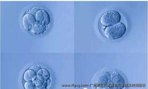 广州第三代试管婴儿流程及时间规划