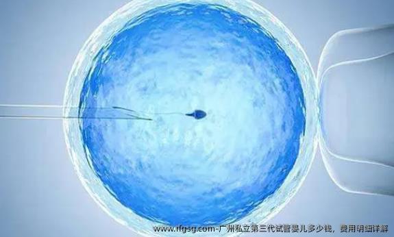 广州私立第三代试管婴儿多少钱，费用明细详解