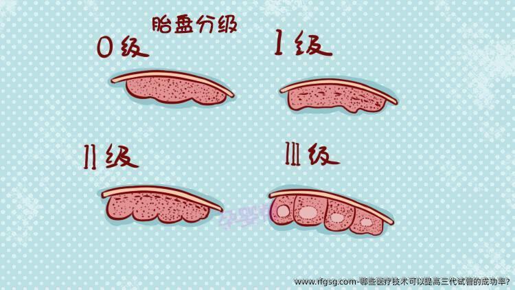 哪些医疗技术可以提高三代试管的成功率?