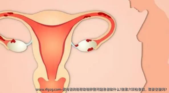 遗传咨询能帮助输卵管问题患者做什么?激素六项检查前，需要空腹吗?