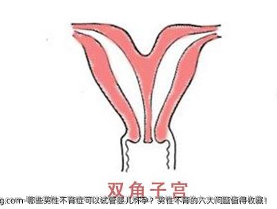 哪些男性不育症可以试管婴儿怀孕？男性不育的六大问题值得收藏！