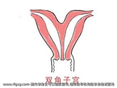 国内单身女可以做试管吗,梧州助孕机构能单身做试管吗
