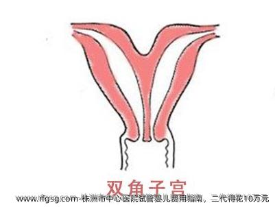 株洲市中心医院试管婴儿费用指南，二代得花10万元