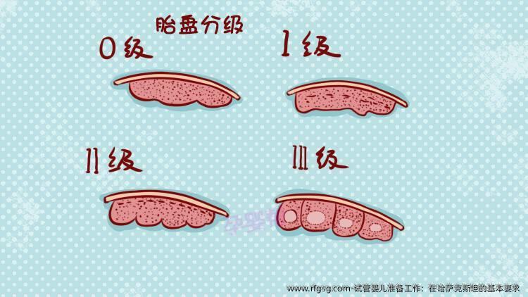 试管婴儿准备工作：在哈萨克斯坦的基本要求 