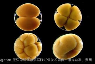 天津中医药附属医院试管技术如何，附成功率、费用
