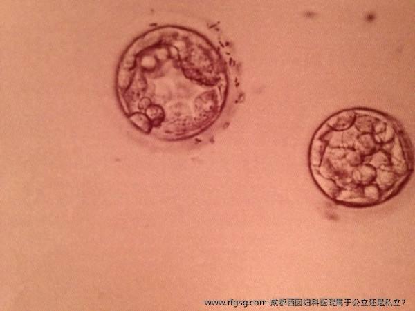 成都西囡妇科医院属于公立还是私立？