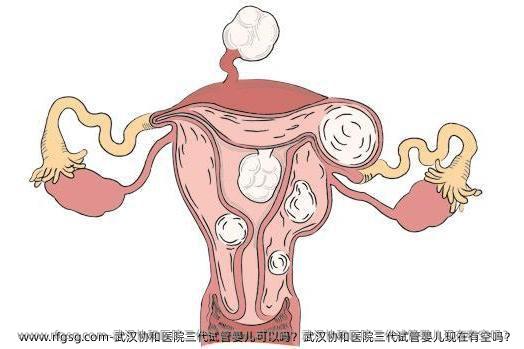 武汉协和医院三代试管婴儿可以吗？武汉协和医院三代试管婴儿现在要排队吗