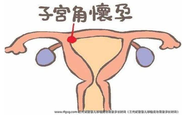 三代试管婴儿移植成功需要多长时间（三代试管婴儿移植成功需要多长时间）