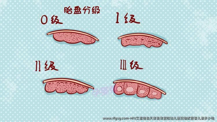 HIV艾滋病去天津美津宜和妇儿医院做试管婴儿要多少钱