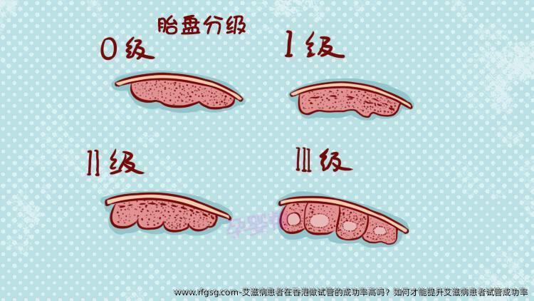艾滋病患者在香港做试管的成功率高吗？如何才能提升艾滋病患者试管成功率
