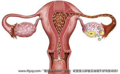 “最佳睡眠时间”出炉！试管婴儿移植后睡眠不好有影响吗?