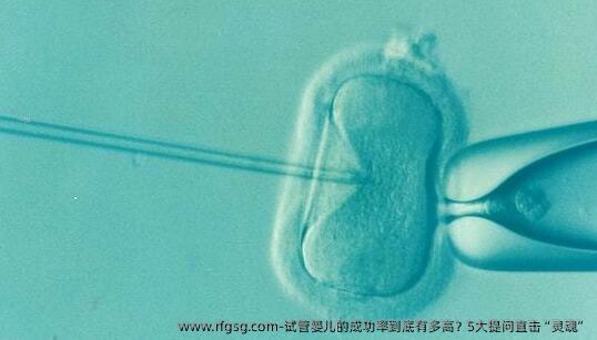 试管婴儿的成功率到底有多高？5大提问直击“灵魂”