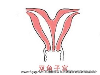 胚胎移植完马上就排尿对结果有影响吗？