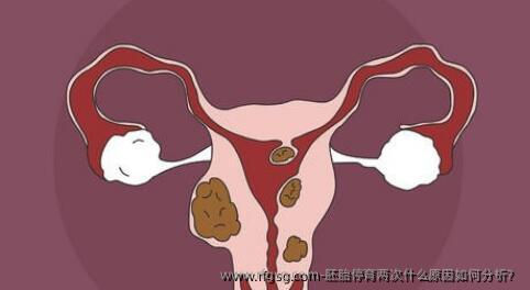 胚胎停育两次什么原因如何分析？