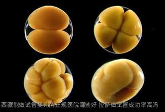 西藏能做试管婴儿的正规医院哪些好 拉萨做试管成功率高吗