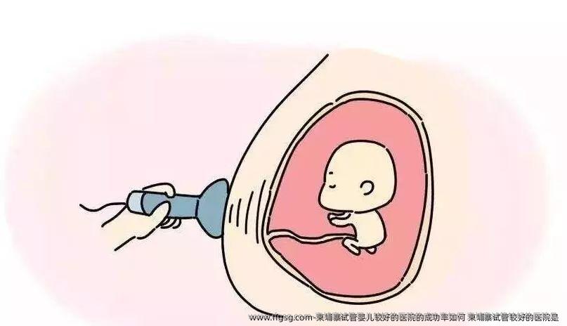 柬埔寨试管婴儿较好的医院的成功率如何 柬埔寨试管较好的医院是
