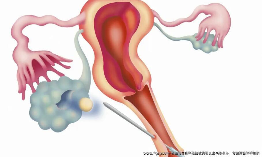 佛山私立机构高龄试管婴儿成功率多少，专家解读年龄影响