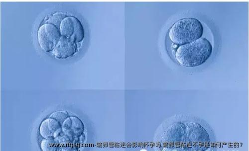 输卵管粘连会影响怀孕吗 输卵管粘连不孕是如何产生的？