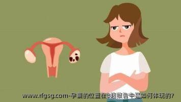 孕囊的位置在B超报告中是如何体现的？