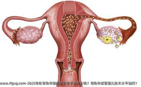 2025年在常熟市做试管生孩子要多少钱？常熟市试管婴儿技术水平如何？