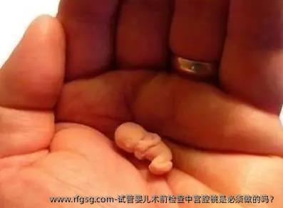 试管婴儿术前检查中宫腔镜是必须做的吗？