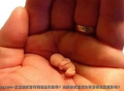宜昌做试管有哪些医院推荐？高龄做试管成功率受哪些因素影响？