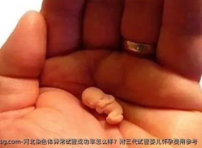 河北染色体异常试管成功率怎么样？附三代试管婴儿怀孕费用参考