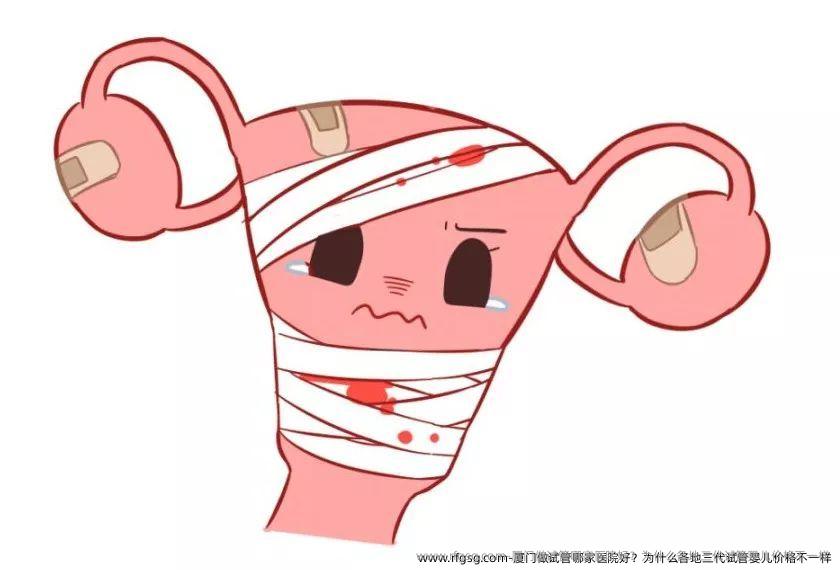 厦门做试管哪家医院好？为什么各地三代试管婴儿价格不一样