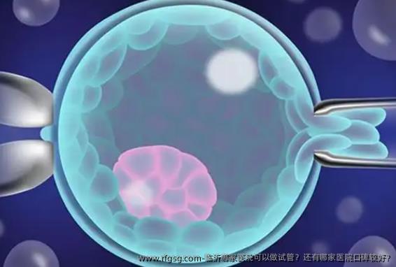 临沂哪家医院可以做试管？还有哪家医院口碑较好?