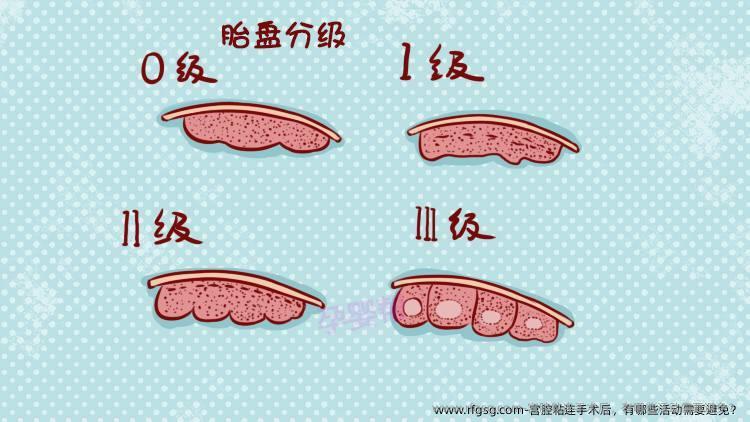 宫腔粘连手术后，有哪些活动需要避免？