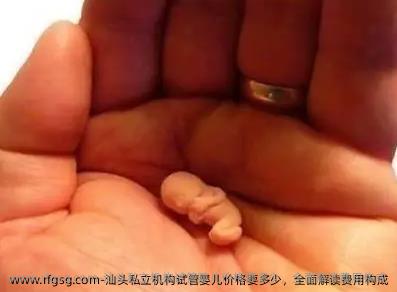 汕头私立机构试管婴儿价格要多少，全面解读费用构成