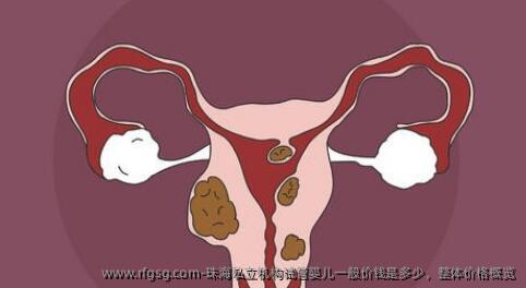 珠海私立机构试管婴儿一般价钱是多少，整体价格概览