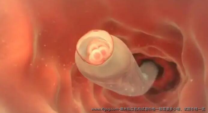 潮州私立机构试管价格一般需要多少钱，试管价格一览