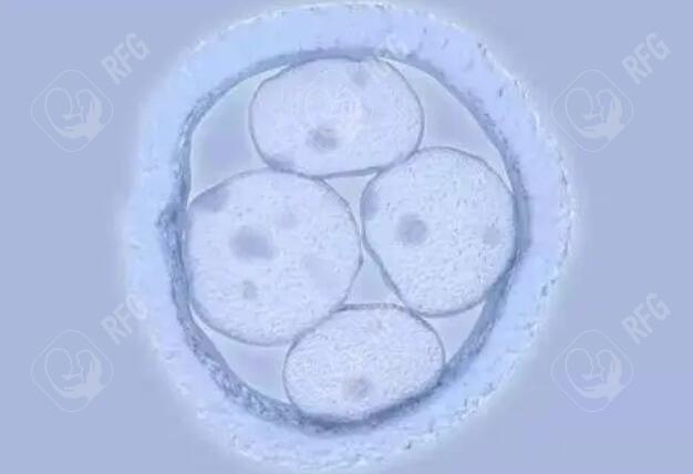 高龄备孕选择指南：自然受孕vs试管婴儿优劣解析