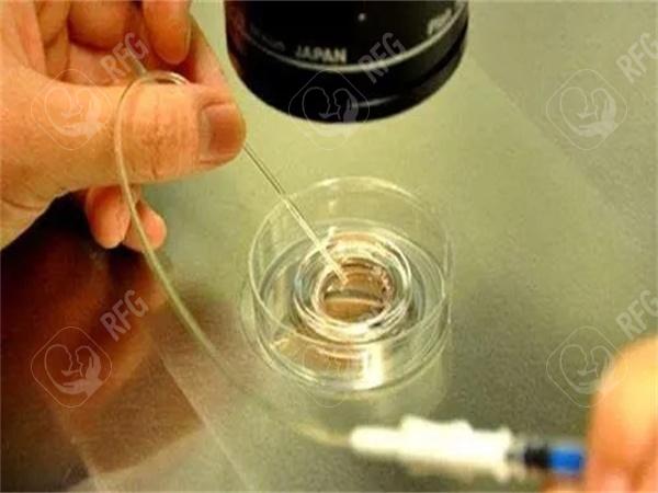 江西试管婴儿费用透明度，哪家医院较具优势？