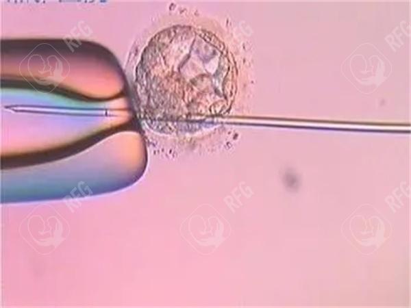 试管婴儿能否一次成功？连云港三代试管高成功率医院权威解答！