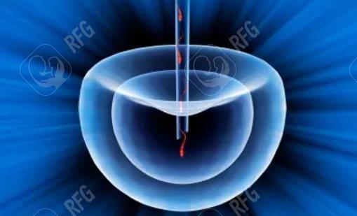 三代试管婴儿多少钱？2025年辅助妊娠过程的预计费用