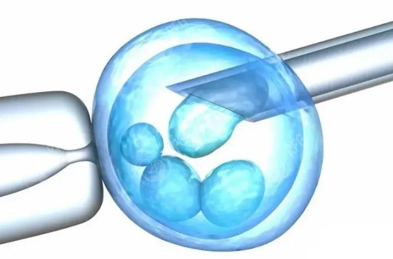 单角子宫可以作为残角子宫的试管吗？解决方案和成功概率的解释