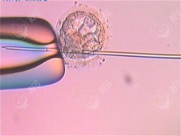 威海做三代试管有哪些医院?少有3家全在威海